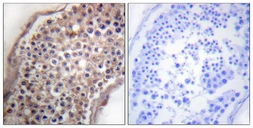 Anti-Ephrin B1/2 antibody used in IHC (Paraffin sections) (IHC-P). GTX87381