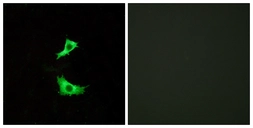 Anti-FFAR3 antibody used in Immunocytochemistry/ Immunofluorescence (ICC/IF). GTX87383
