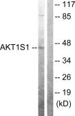 Anti-PRAS40 antibody used in Western Blot (WB). GTX87391