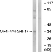 Anti-OR4F4 + OR4F5 + OR4F17 antibody used in Western Blot (WB). GTX87394