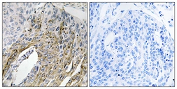 Anti-LONP2 antibody used in IHC (Paraffin sections) (IHC-P). GTX87395