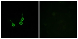Anti-GPR150 antibody used in Immunocytochemistry/ Immunofluorescence (ICC/IF). GTX87397
