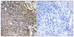 Anti-SH2D1B antibody used in IHC (Paraffin sections) (IHC-P). GTX87405