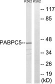 Anti-PABPC5 antibody used in Western Blot (WB). GTX87409