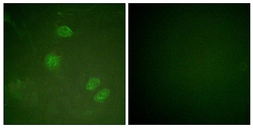 Anti-ELK3 antibody used in Immunocytochemistry/ Immunofluorescence (ICC/IF). GTX87410