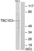 Anti-TBC1D3 antibody used in Western Blot (WB). GTX87412