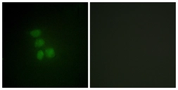 Anti-hnRNP G antibody used in Immunocytochemistry/ Immunofluorescence (ICC/IF). GTX87416