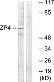 Anti-ZP4 antibody used in Western Blot (WB). GTX87417
