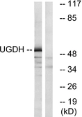 Anti-UGDH antibody used in Western Blot (WB). GTX87421