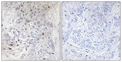 Anti-MAFF antibody used in IHC (Paraffin sections) (IHC-P). GTX87425