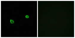 Anti-IRE1 beta antibody used in Immunocytochemistry/ Immunofluorescence (ICC/IF). GTX87426