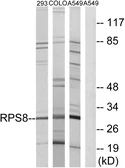 Anti-RPS8 antibody used in Western Blot (WB). GTX87428