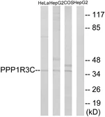 Anti-PPP1R3C antibody used in Western Blot (WB). GTX87429