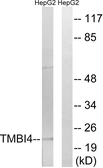 Anti-TMBIM4 antibody used in Western Blot (WB). GTX87431