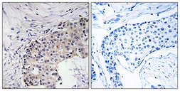 Anti-SCARF2 antibody used in IHC (Paraffin sections) (IHC-P). GTX87437