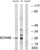 Anti-SCN4B antibody used in Western Blot (WB). GTX87443