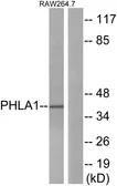 Anti-PHLDA1 antibody used in Western Blot (WB). GTX87448