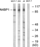 Anti-N4BP1 antibody used in Western Blot (WB). GTX87451