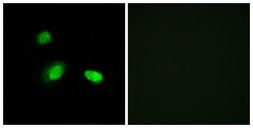 Anti-HSPB2 antibody used in Immunocytochemistry/ Immunofluorescence (ICC/IF). GTX87453