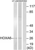 Anti-HOXA6 antibody used in Western Blot (WB). GTX87454