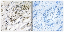 Anti-CDYL2 antibody used in IHC (Paraffin sections) (IHC-P). GTX87476
