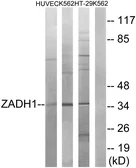 Anti-ZADH1 antibody used in Western Blot (WB). GTX87478