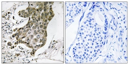 Anti-RABEP1 antibody used in IHC (Paraffin sections) (IHC-P). GTX87480