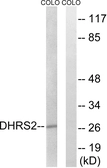 Anti-DHRS2 antibody used in Western Blot (WB). GTX87483