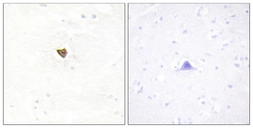 Anti-JAKMIP2 antibody used in IHC (Paraffin sections) (IHC-P). GTX87490