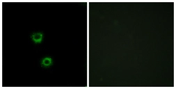Anti-TMEM30C antibody used in Immunocytochemistry/ Immunofluorescence (ICC/IF). GTX87491