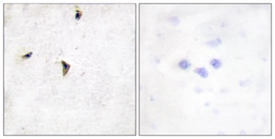 Anti-Kv2.1 antibody used in IHC (Paraffin sections) (IHC-P). GTX87498
