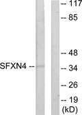 Anti-SFXN4 antibody used in Western Blot (WB). GTX87501