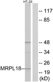 Anti-MRPL18 antibody used in Western Blot (WB). GTX87512