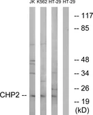 Anti-CHP2 antibody used in Western Blot (WB). GTX87522