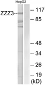 Anti-ZZZ3 antibody used in Western Blot (WB). GTX87527