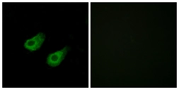 Anti-JIP3 antibody used in Immunocytochemistry/ Immunofluorescence (ICC/IF). GTX87530