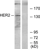 Anti-Her2 / ErbB2 antibody used in Western Blot (WB). GTX87531