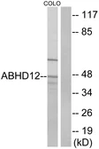 Anti-ABHD12 antibody used in Western Blot (WB). GTX87533
