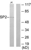 Anti-SP2 antibody used in Western Blot (WB). GTX87534