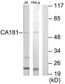 Anti-ZNHIT6 antibody used in Western Blot (WB). GTX87536