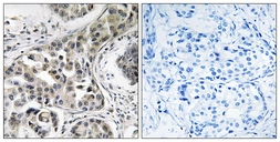 Anti-USP6NL antibody used in IHC (Paraffin sections) (IHC-P). GTX87538