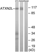 Anti-ATXN2L antibody used in Western Blot (WB). GTX87539