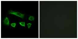 Anti-NT5C1B antibody used in Immunocytochemistry/ Immunofluorescence (ICC/IF). GTX87540
