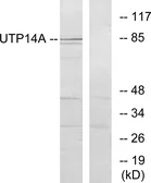 Anti-UTP14A antibody used in Western Blot (WB). GTX87543