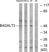 Anti-B4GALT3 antibody used in Western Blot (WB). GTX87547