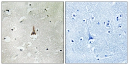 Anti-LRP10 antibody used in IHC (Paraffin sections) (IHC-P). GTX87552