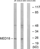 Anti-MED18 antibody used in Western Blot (WB). GTX87555