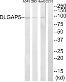Anti-HURP antibody used in Western Blot (WB). GTX87559