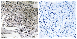 Anti-PIG-Y antibody used in IHC (Paraffin sections) (IHC-P). GTX87565