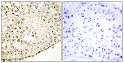Anti-SPZ1 antibody used in IHC (Paraffin sections) (IHC-P). GTX87570